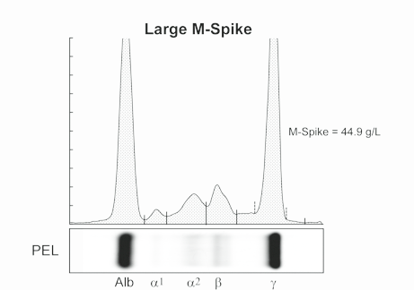 Use Hevylite when SPE is non-linear