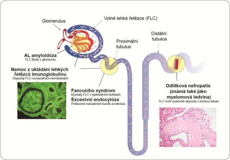 Renal Overview