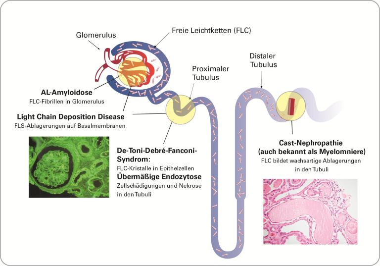 Renal Overview