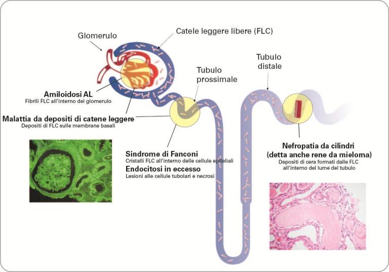 Renal overview