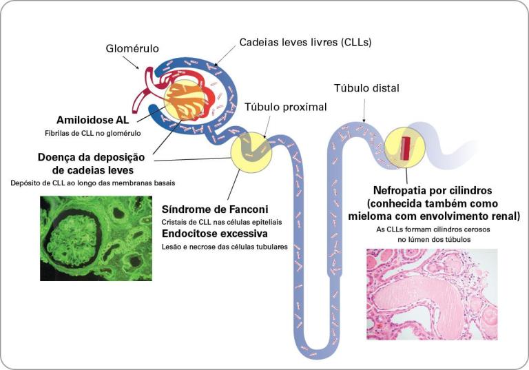 Kidney Overview
