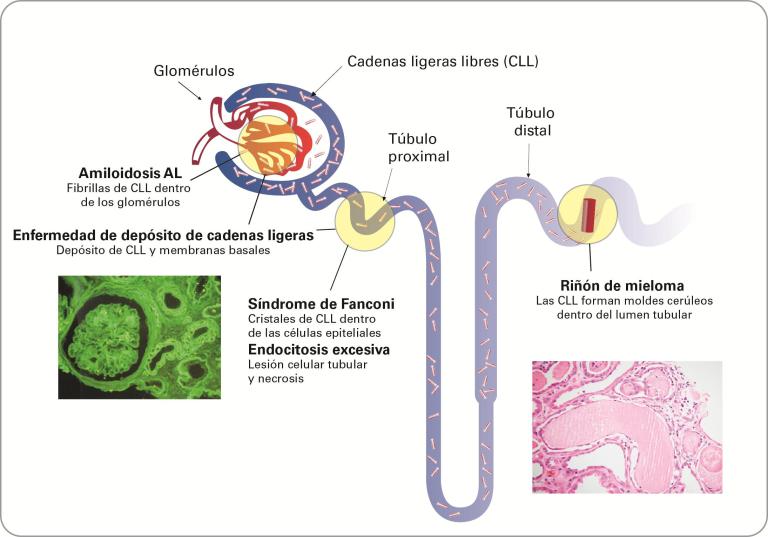 Renal Overview